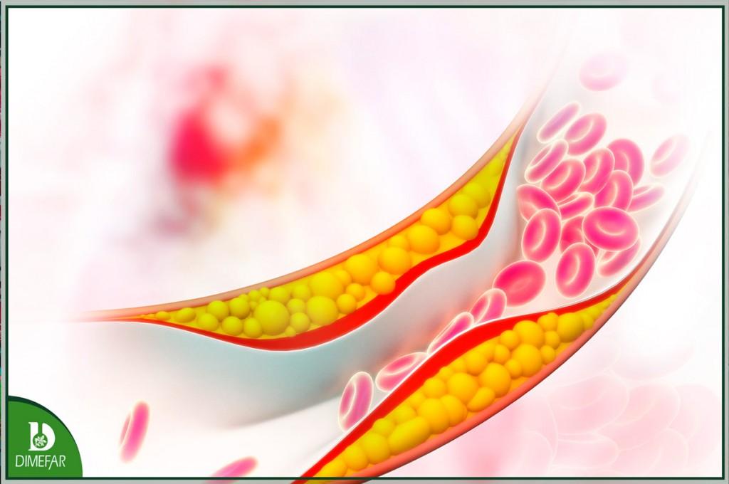 El colesterol elevado, la tercera enfermedad más frecuente en España